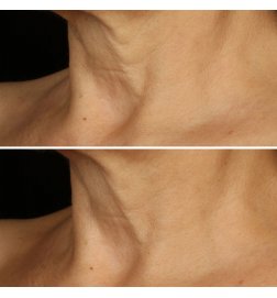 Smart Clinical Repair - Crème Liftante Visage + Cou Smart Clinical Repair - Crème Liftante Visage + Cou